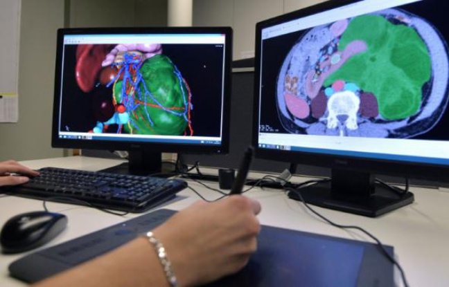 Un employé de "Visible Patient", start-up émanant de l'Institut de recherche contre les cancers de l'appareil digestif (Ircad), le 25 janvier 2016 à Strasbourg Un employé de "Visible Patient", start-up émanant de l'Institut de recherche contre les cancers de l'appareil digestif (Ircad), le 25 janvier 2016 à Strasbourg