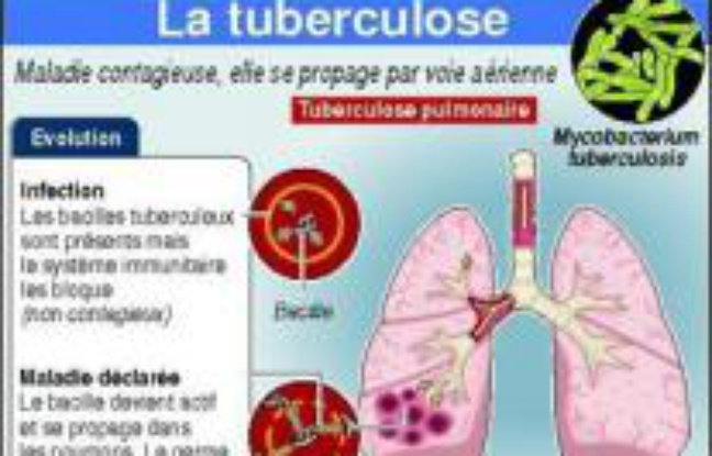 Les problèmes avec la puissance dans 18 ans de la raison