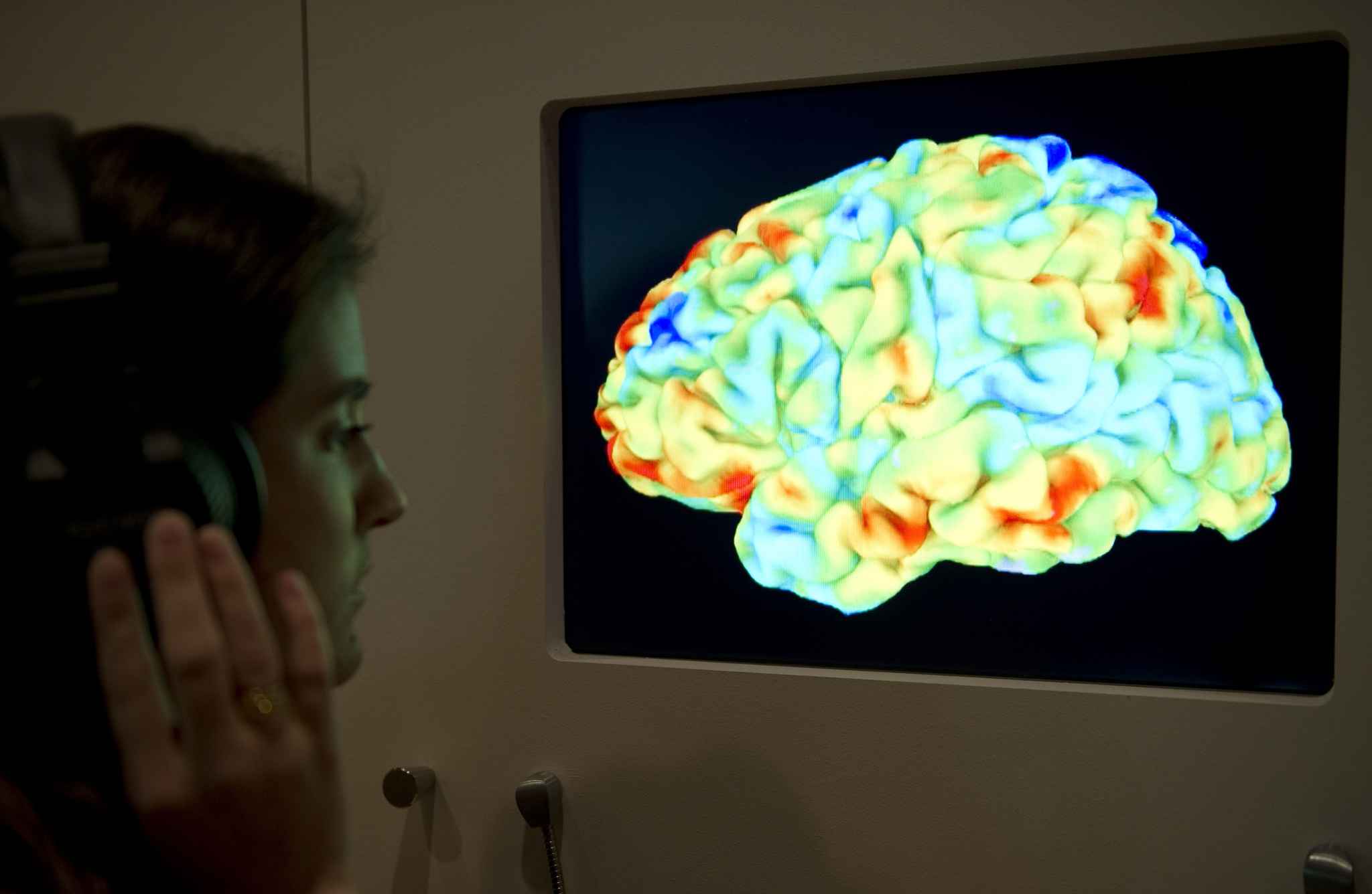 Il Se Fait Dévorer Le Cerveau Que se passe-t-il dans le cerveau de Sting quand il écoute de la musique?