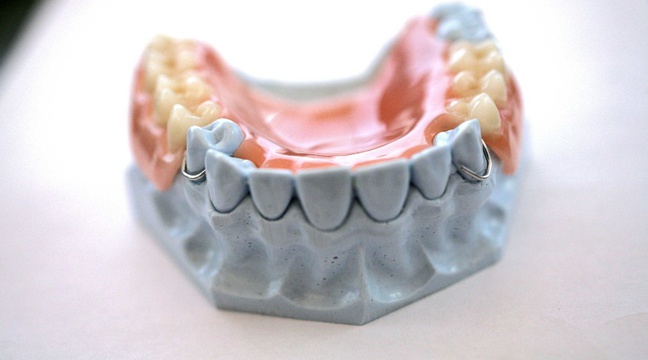 Prothesiste dentaire en guadeloupe 08 picture