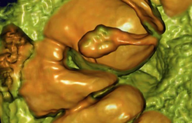 Illustration d'un colon. Illustration d'un colon.