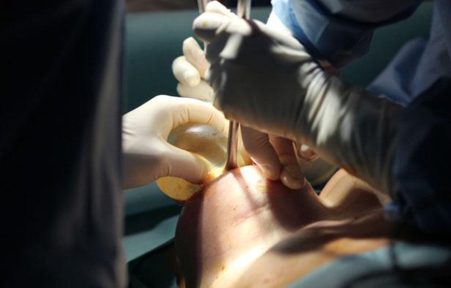 Une femme opérée à l'hôpital de Nice pour lui enlever une prothèse mammaire défectueuse, le 21 décembre 2011. Une femme opérée à l'hôpital de Nice pour lui enlever une prothèse mammaire défectueuse, le 21 décembre 2011.