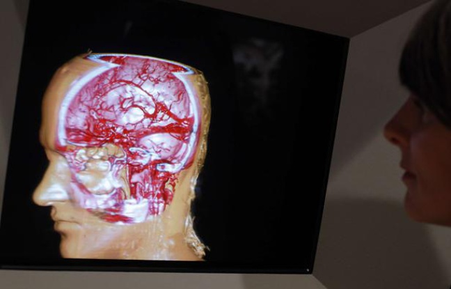 Imagerie cérébrale en 3D. Imagerie cérébrale en 3D.