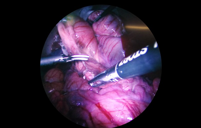 http://img.20mn.fr/ZjIRUebSRLewFCc8OzSzrQ/648x415_prototype-endoscope-8k