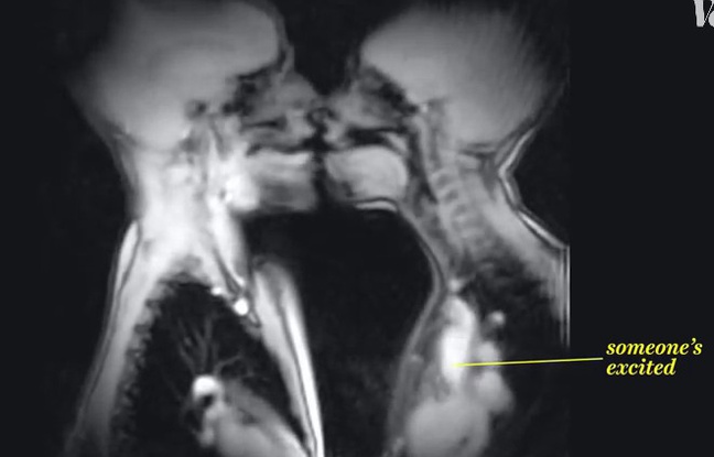 Un baiser vu par IRM. Un baiser vu par IRM.