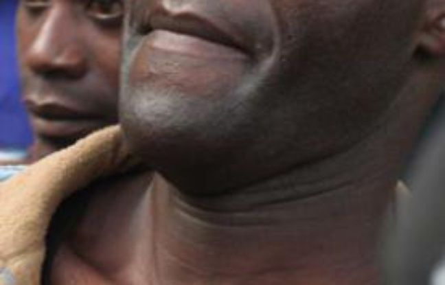 Tiwonge Chimbalanga, à droite, et Steven Monjeza après leur condamnation au tribunal de Blantyre au Malawi, le 20 mai 2010. Tiwonge Chimbalanga, à droite, et Steven Monjeza après leur condamnation au tribunal de Blantyre au Malawi, le 20 mai 2010.