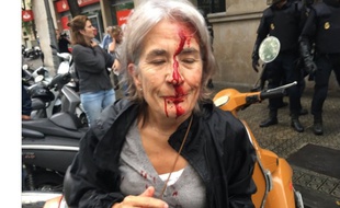 Une dame le visage en sang en Catalogne le 1er octobre 2017.