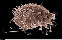 Neuf soignants contaminés par la gale transmise par un patient