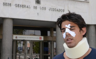 Le joueur de tennis Thomas Drouet, sparring-partner de Bernard Tomic, après son agression à Madrid, le 6 mai 2013.