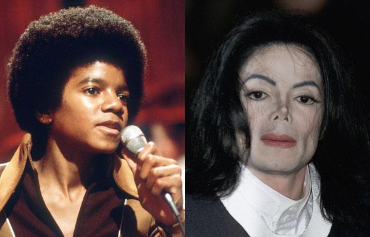 Comment Michael Jackson Est Devenu Blanc Michael Jackson, au carrefour du génie, de la démesure et de l'ambiguïté