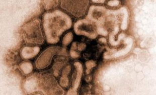 Le virus H1N1 de la grippe porcine isolé au cours de l'épidémie de 1976, aux Etats-Unis.