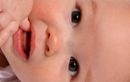 Aphtes et herpès, ces petites plaies qui peuvent apparaître dans la bouche de bébé