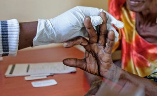 Le vaccin a été testé à grande échelle au Ghana, au Kenya et au Malawi.