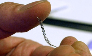 Depuis 2005, le dispositif Essure a été implanté à 175.000 femmes en France.