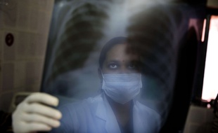 Une infirmière indienne scrute la radiographie du thorax d'un patient suspecté d'avoir la tuberculose.