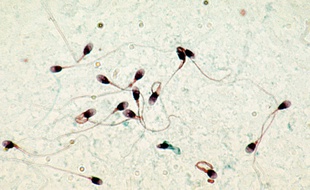 Vue microscopique de spermatozoïdes.