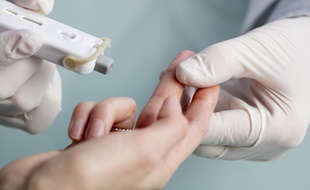 Le test est réalisé à partir d'une simple goutte de sang prélevée au bout du doigt du patient.
