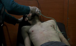 Un homme pris en charge dans un hôpital de fortune après une attaque aux armes chimique par les troupes de Bachar al-Assad, à Derayya, dans le sud-ouest de Damas le 13 janvier 2014