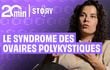 Eva, atteinte du SOPK