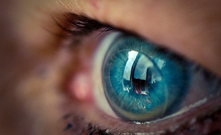 La patiente ne s'était pas rendu compte qu'elle avait 27 lentilles de contact dans l'oeil (illustration).
