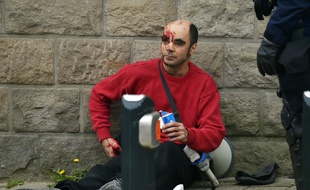 L'homme blessé par un coup de matraque le 24 mars boulevard Amiral-Courbet à Nantes.
/ AFP / L.Venance