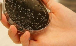 Le gouvernement portugais a annoncé que l'épidémie était probablement due à la présence de bactéries dans les tours de réfrigération d'une usine d'engrais.