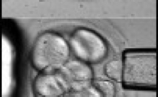 Après avoir prélevé une unique cellule sur des embryons humains de huit à dix cellules, une équipe américaine a réussi à produire deux lignées de cellules souches embryonnaires sans provoquer la mort des embryons utilisés, rapporte mercredi la revue britannique Nature.