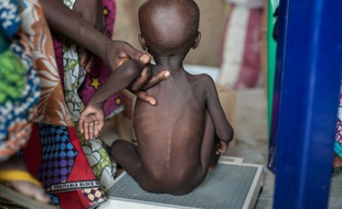 Une fillette souffrant de sévère malnutrition est pesée le 30 juin 2016 dans un centre de soins de l'Unicef, dans le campement de Muna, banlieue de Maiduguri