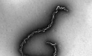 Leptospira interrogans, la bactérie responsable de la leptospirose.