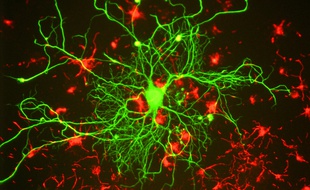 Neurones de rat en croissance