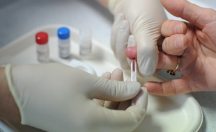 NANTES, le 16/11/2011 Teste Rapide d'Orientation Diagnostique TROD, pour depister rapidement un HIV a l aide d un teste sanguin