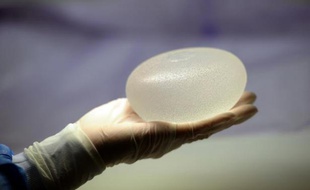Des cas de cancers rares ont été dépistés en France chez des femmes porteuses d'implants mammaires, mais aucun retrait préventif n'a été conseillé par les autorités sanitaires
