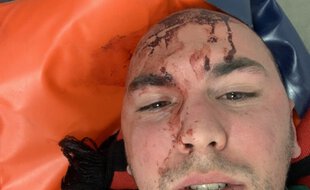 Rémi a été blessé à la tête pendant la mi-temps du derby du Nord