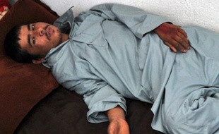 Abdullah, 18 ans, est amorphe. Une conséquence de la décharge électrique que lui a infligée la police iranienne en le chassant du pays. Son bras est zébré de peinture rouge, afin qu'il soit "marqué" comme tous ses compatriotes expulsés.