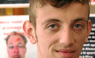 Raphaël a reçu un coup à la tête.
