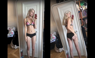 Agnes Hedengard, mannequin suédois de 19 ans, dénonce dans une vidéo la maigreur imposée par l'industrie de la mode.