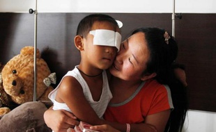 Un garçonnet chinois sauvagement énucléé, dont le sort a ému le pays et au-delà, a été opéré mardi à Shenzhen (sud) par un médecin hongkongais qui devait lui poser des yeux artificiels.