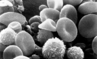 Cellules sanguines vues au microscope électronique