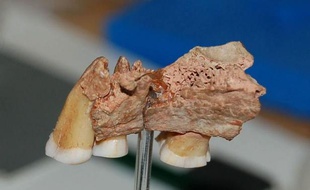 Durant des décennies, les paléontologues ont pensé que ce maxillaire humain n'était qu'un fossile préhistorique parmi d'autres. En y regardant de plus près, ils se sont aperçus que son propriétaire était le plus vieil homme moderne jamais identifié en Europe occidentale.