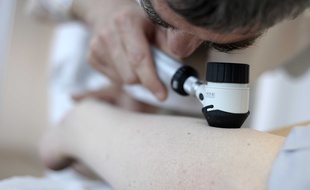 Un dermatologue nantais ausculte un patient pour detecter la presence ou non de mélanomes sur la peau.