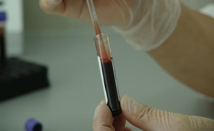 Illustration d'un examen de sangé pour parler du diagnostic néonatal des maladies rares.