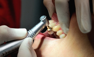 Illustration: un patient chez le dentiste.