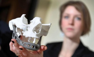 Une mâchoire artificielle conçue grâce à une technique innovante d'imagerie 3D a été implantée à une patiente aux Pays-Bas, qui a notamment retrouvé ainsi l'usage de la parole, a annoncé jeudi l'équipe qui a réalisé cette opération présentée comme une première mondiale.