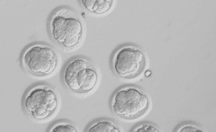 Le gène porteur de la cardiomyopathie hypertrophique a été corrigé avec succès dans des embryons humains.
