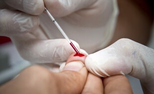 Un test de dépistage du VIH. (illustration)