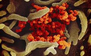 Le SARS-CoV-2 isolé sur un patient (illustration).
