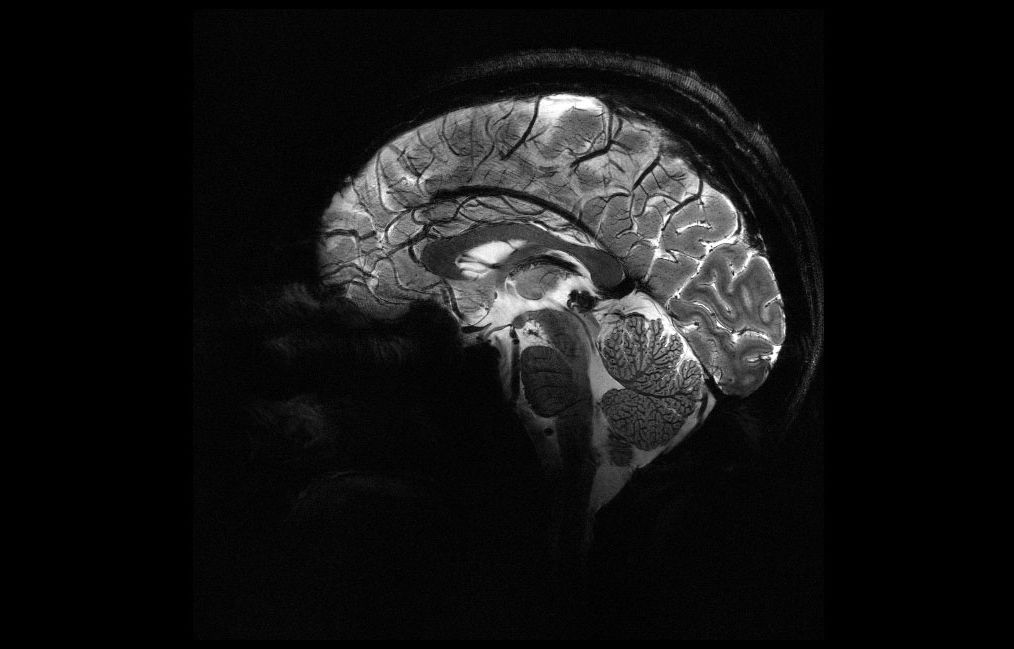 Voici les images du cerveau les plus précises jamais publiées