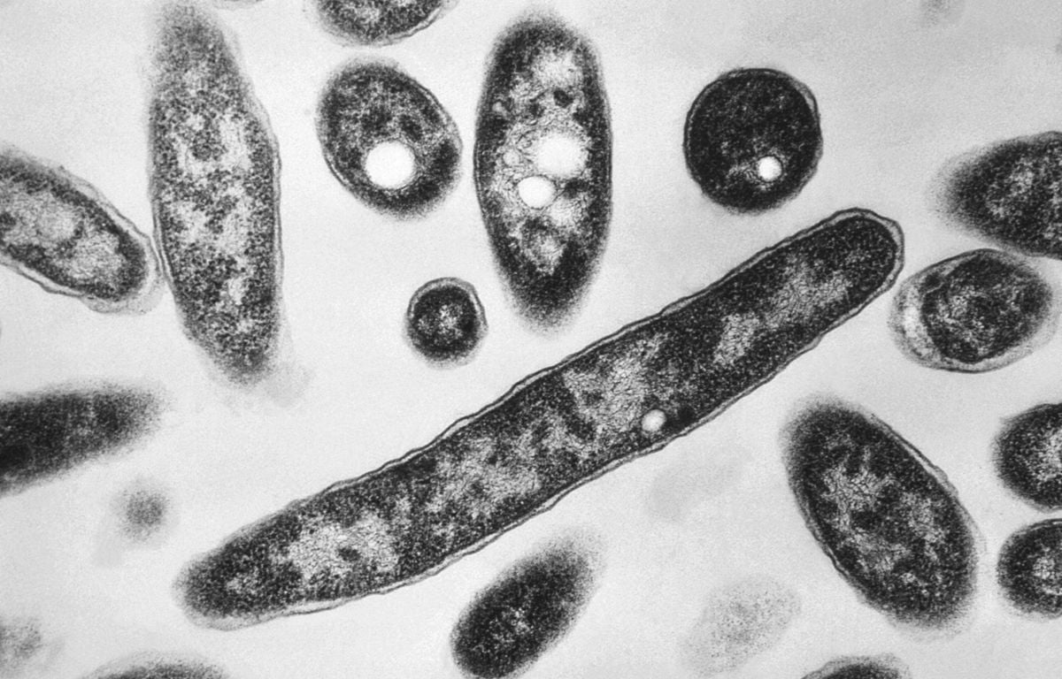 Légionellose : Six nouveaux cas dont deux mortels, en Haute-Saône cette fois