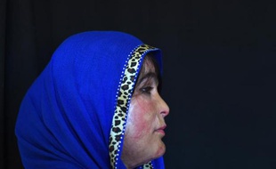 Mumtaz, victime afghane d'une attaque à l'acide de la part d'un prétendant éconduit, à Kunduz, le 20 mai 2015