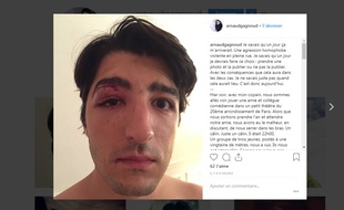 Le comédien Arnaud Gagnoud a raconté sur les réseaux sociaux l'agression homophobe dont son ami et lui ont été victimes